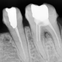 Dental Imaging Dental Imaging