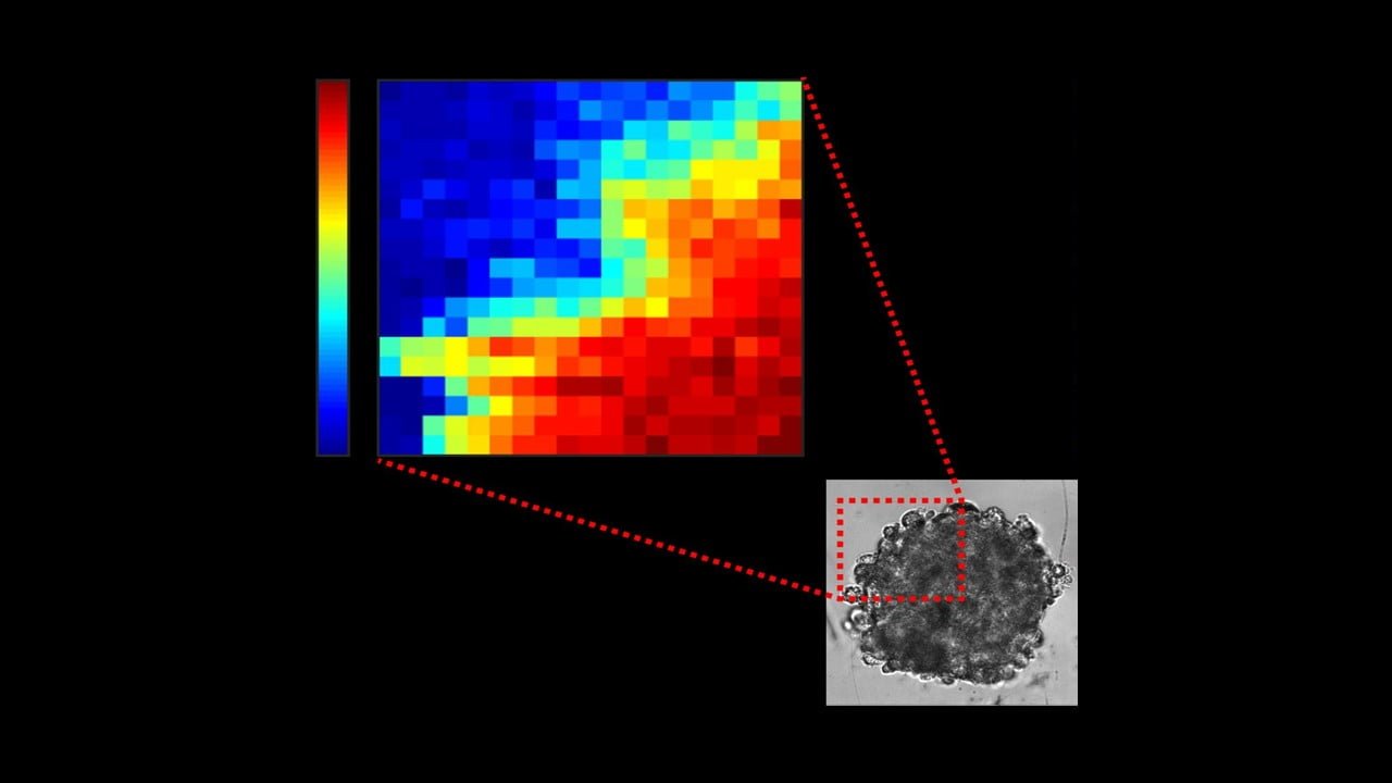 Light-Scattering Method Maps Tumors