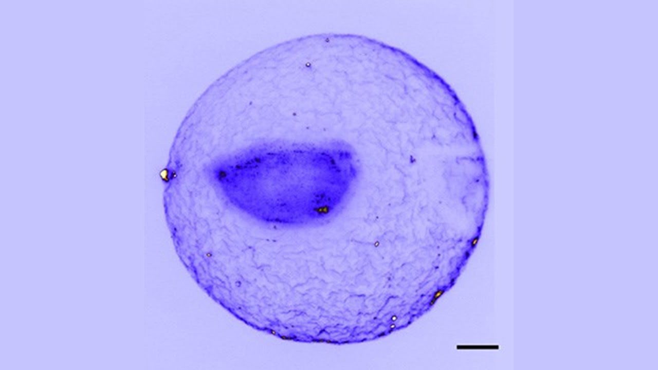 Light-Sheet Fluorescence Microscopy Improvement