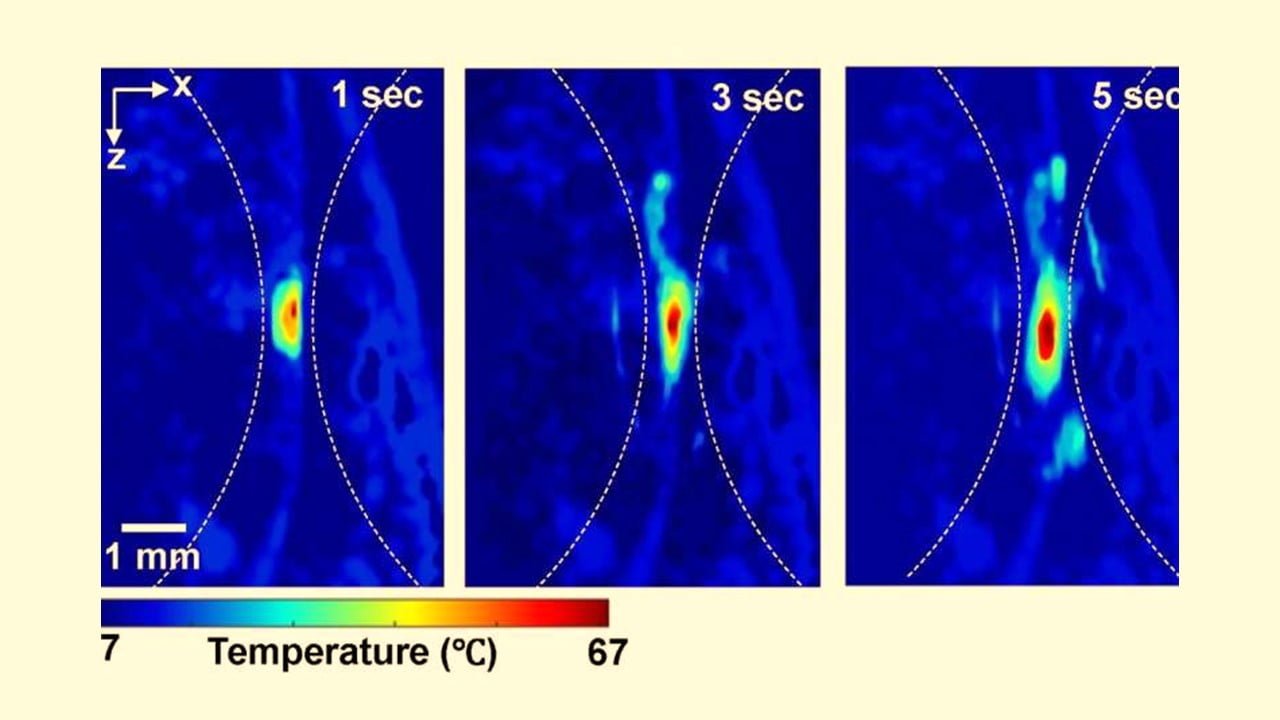 Deep Tissues – Light, Sound Measure Temperature