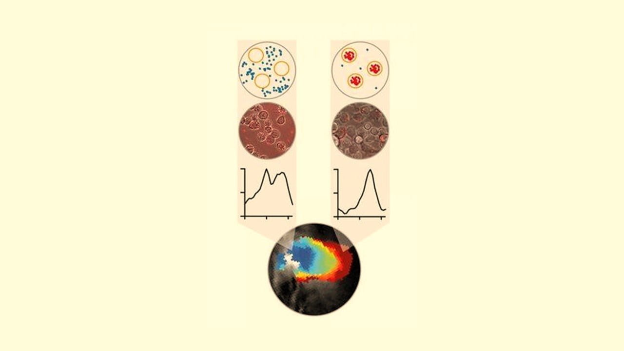 Optoacoustic Imaging Detects Tumor Development