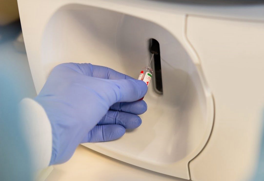 Breath Analyzer Detects Deadly Blood Clots | Syntec Optics