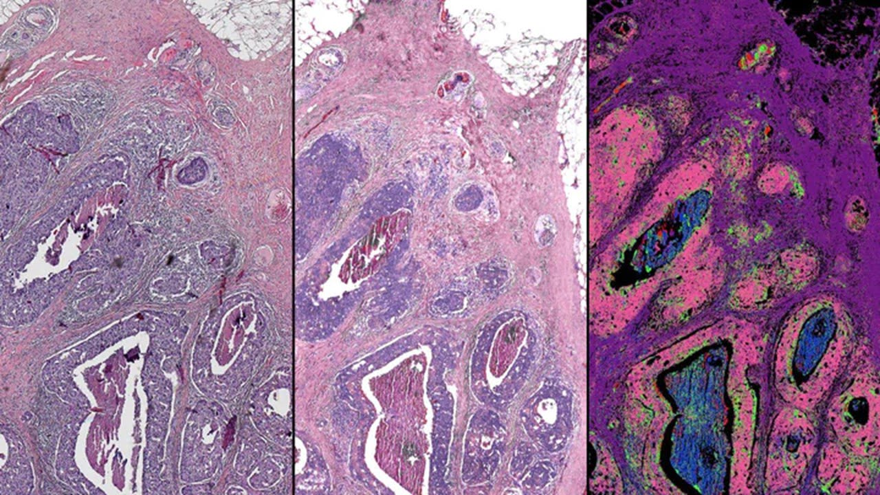 Infrared Microscope