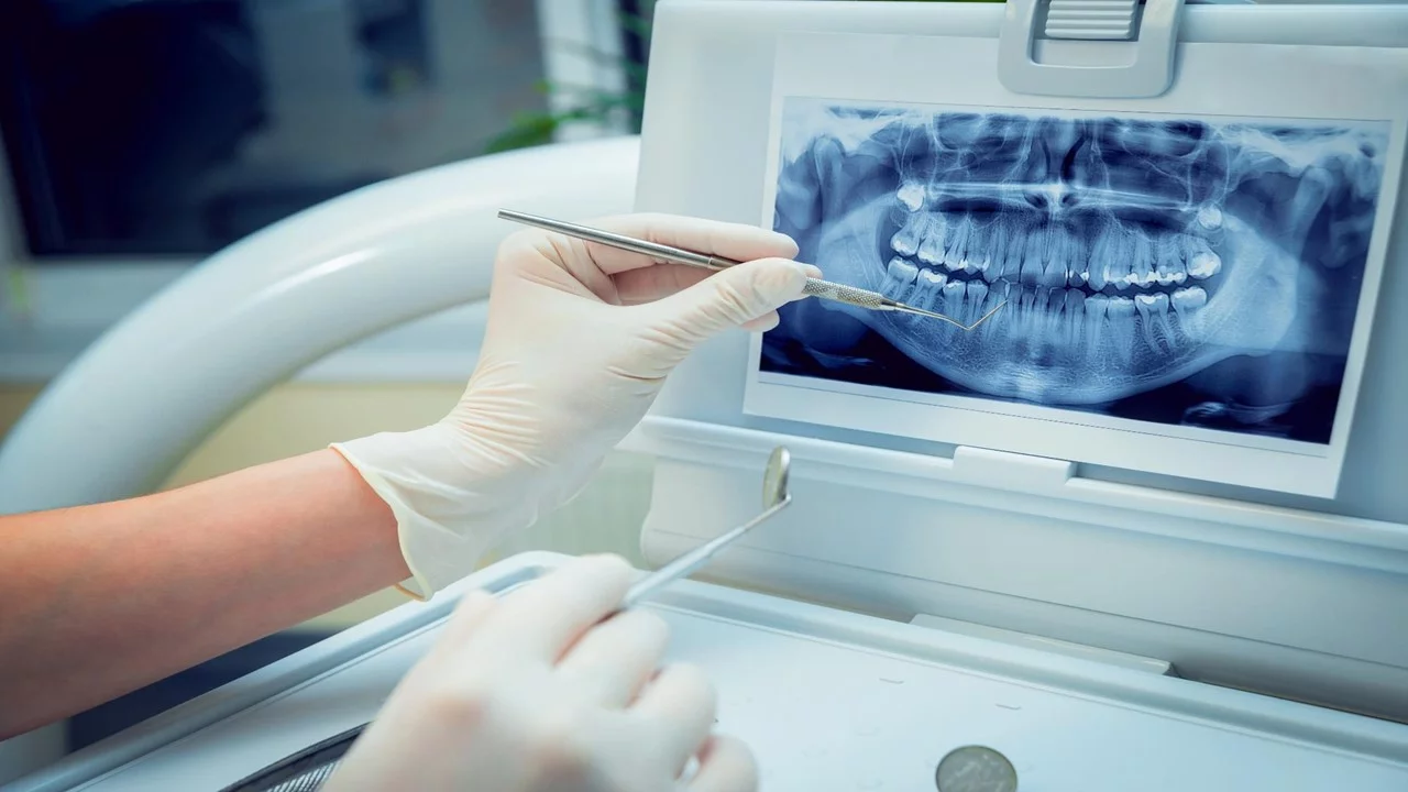 Dental Exam – NIR Light Outperforms X-Rays