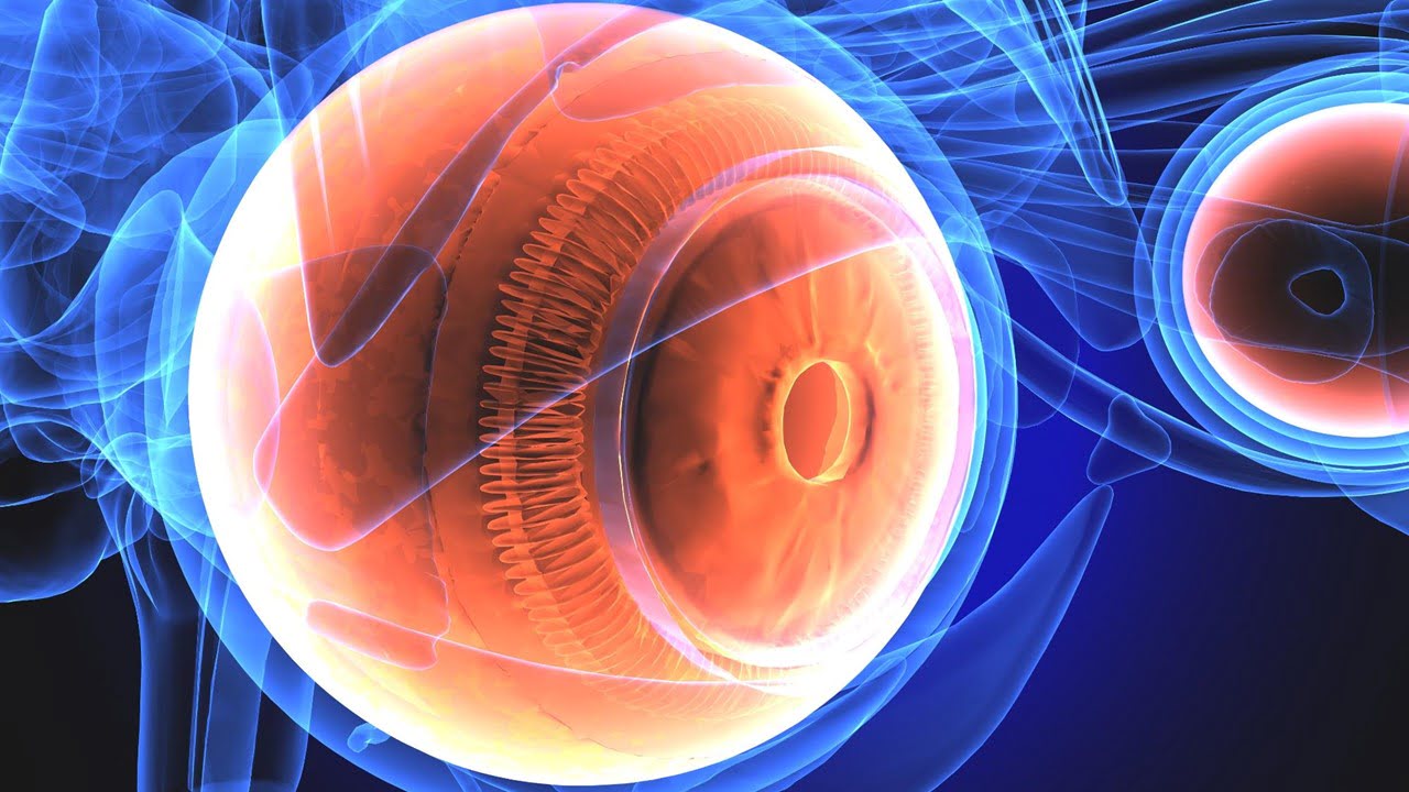 Intraocular Lens Tunability Will End Exchanges